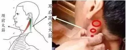 記住“三條筋”，能治很多??！(圖1)